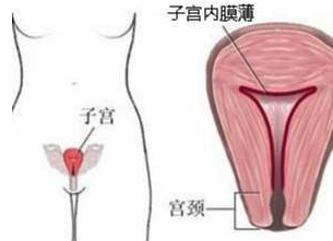 结婚5年怀孕2次都没成功，我的孩子去哪了？